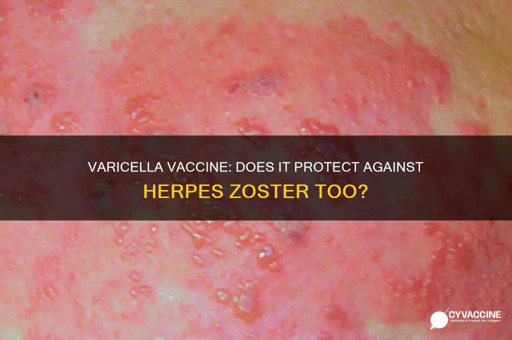 does varicella vaccine prevent herpes zoster