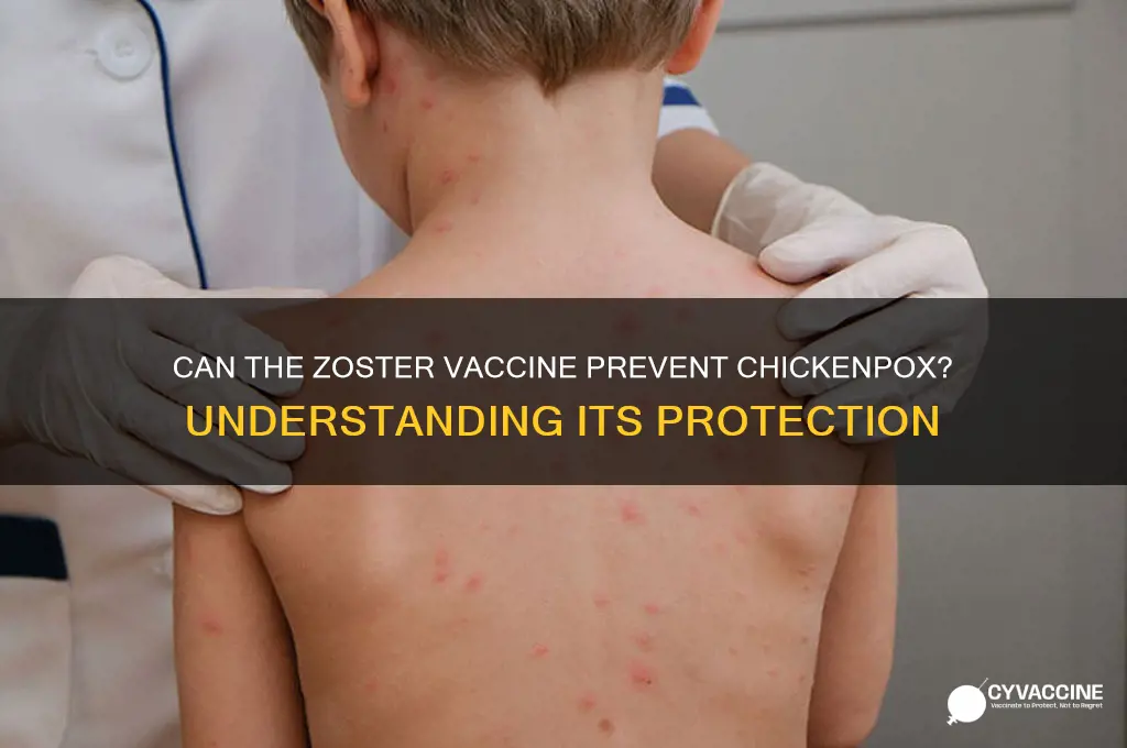 does zoster vaccine protect against chickenpox