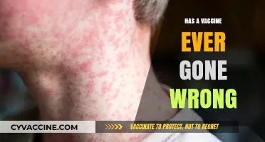 Vaccine Safety Concerns: Historical Cases of Failed Immunizations Explored
