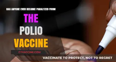 Polio Vaccine and Paralysis: Separating Fact from Fiction
