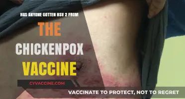 Can the Chickenpox Vaccine Cause HSV-2? Unraveling the Facts