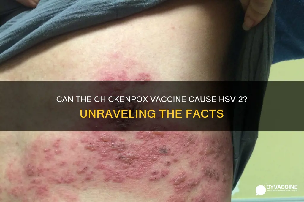 has anyone gotten hsv 2 from the chickenpox vaccine