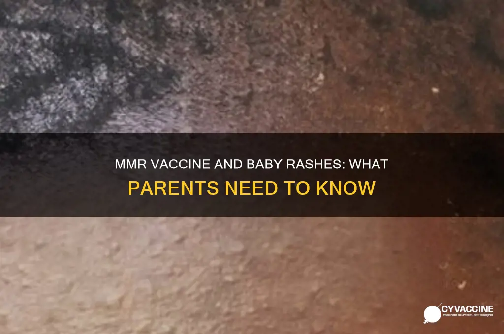 has anyones baby got rash after mmr vaccine