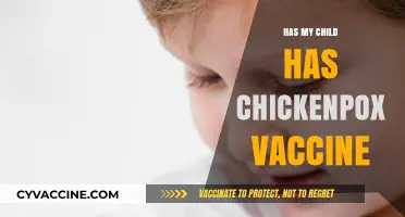 Has Your Child Had the Chickenpox Vaccine? What Parents Need to Know