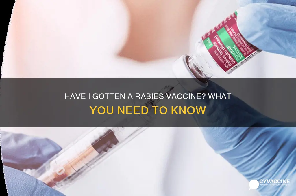 have i gotten a rabies vaccine
