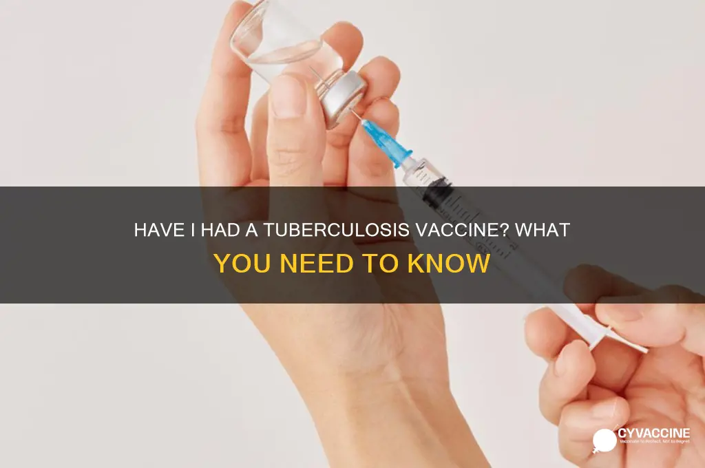 have i had a tuberculosis vaccine