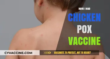 Have I Had the Chicken Pox Vaccine? How to Check Your Immunization Status