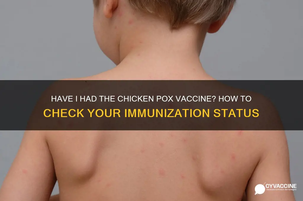 have i had chicken pox vaccine