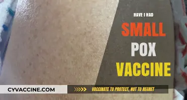 Did I Receive the Smallpox Vaccine? Unraveling My Immunization History