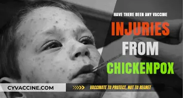 Chickenpox Vaccine Safety: Examining Potential Injuries and Side Effects