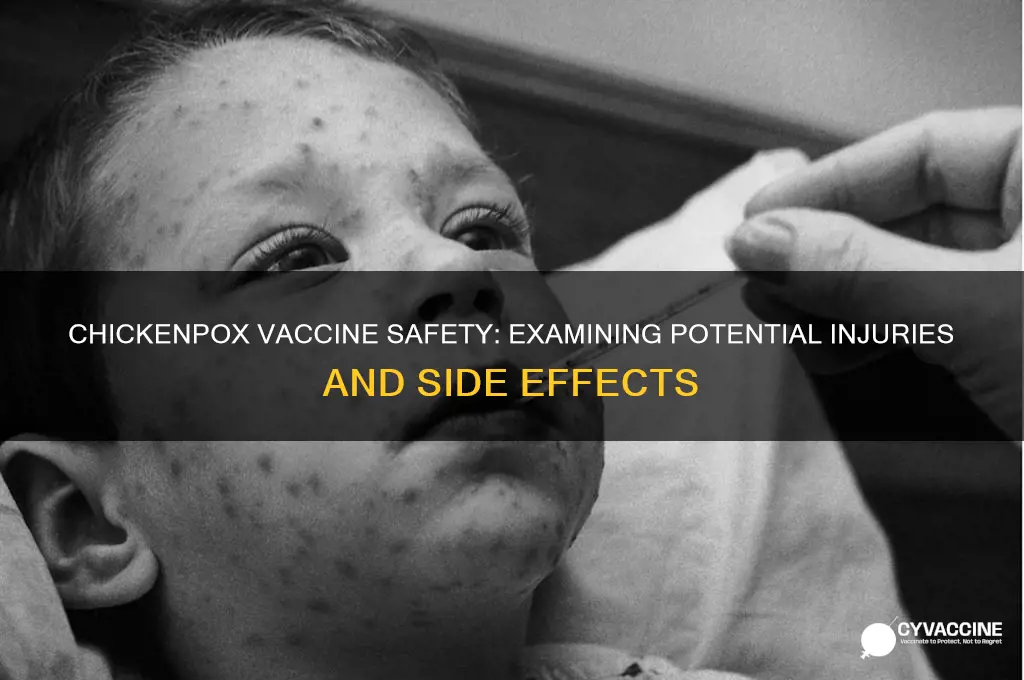 have there been any vaccine injuries from chickenpox