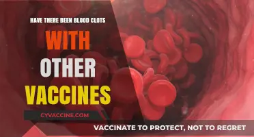 Blood Clots and Vaccines: Historical Context Beyond Recent Concerns