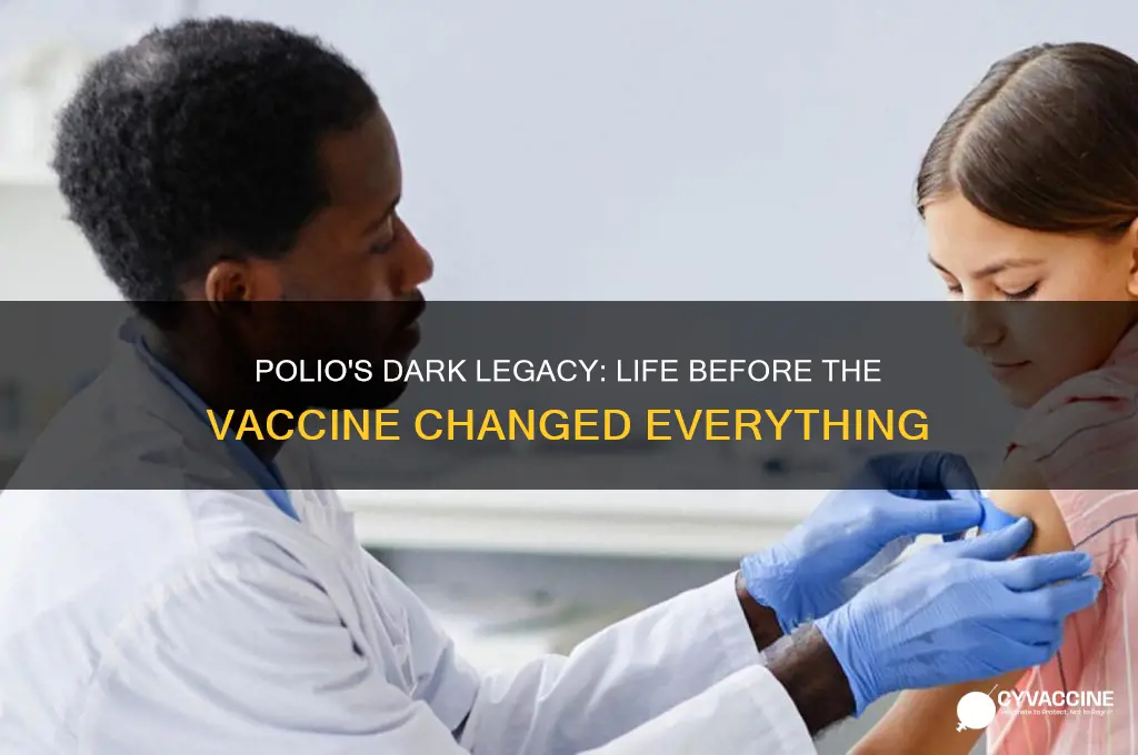 how bad was polio before vaccine