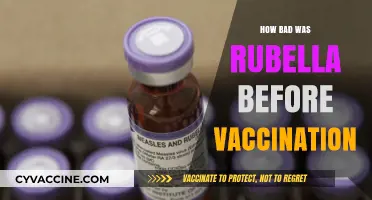 Rubella's Devastating Impact: A Pre-Vaccination Era Revealed