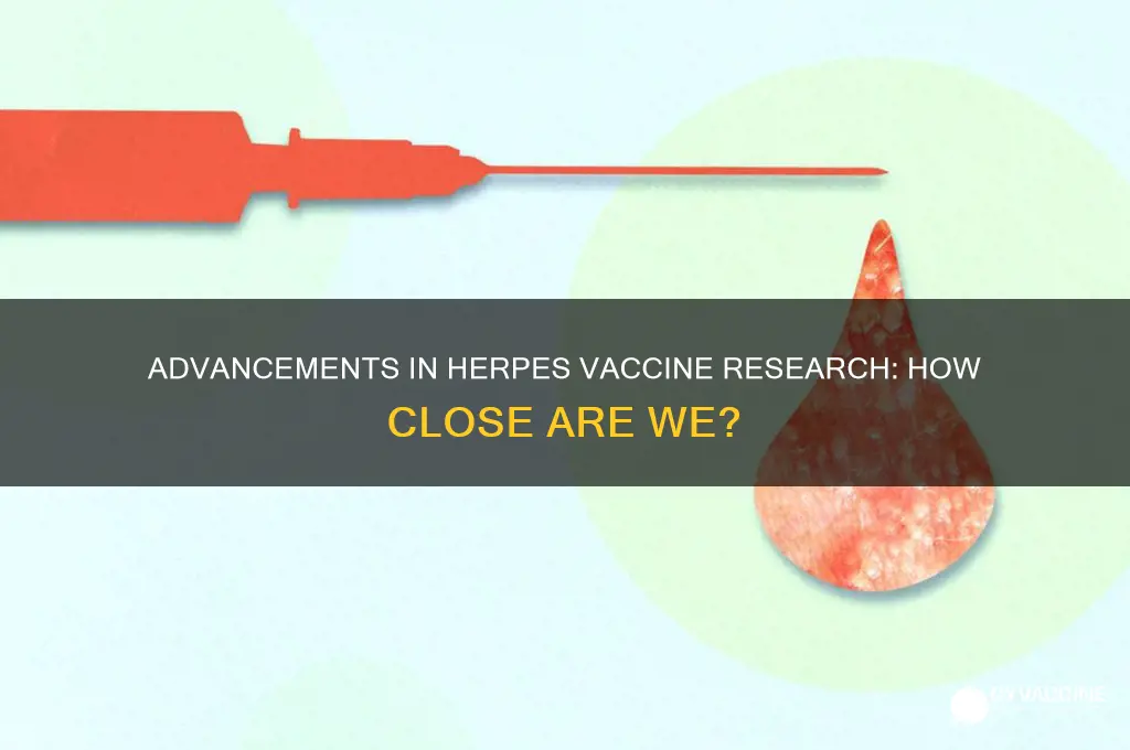 how close are we to a herpes vaccine