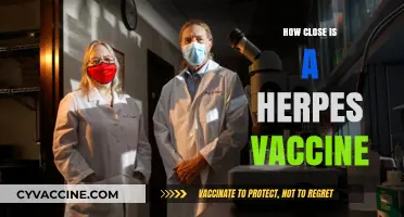Herpes Vaccine Progress: How Close Are We to a Breakthrough?