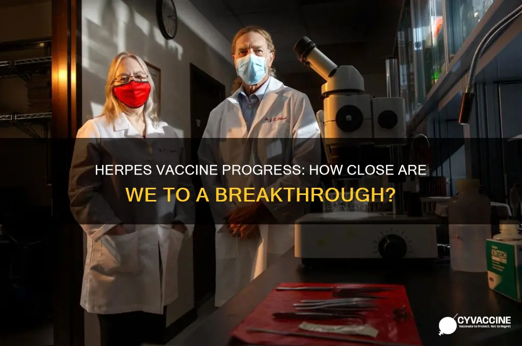 how close is a herpes vaccine