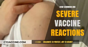 Understanding Severe Vaccine Reactions: Frequency, Risks, and Safety Measures