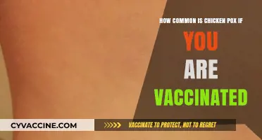 Vaccinated Against Chickenpox: How Common Are Breakthrough Cases?
