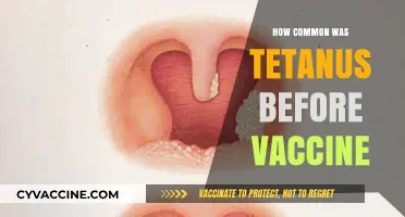 Tetanus Before Vaccination: Uncovering the Prevalence of a Deadly Disease