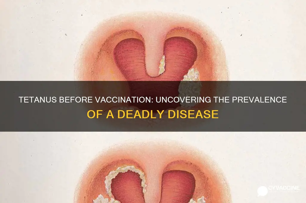 how common was tetanus before vaccine
