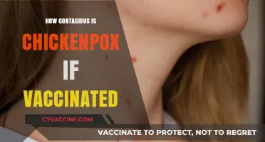 Vaccinated and Exposed: Understanding Chickenpox Contagion Risks Post-Vaccination