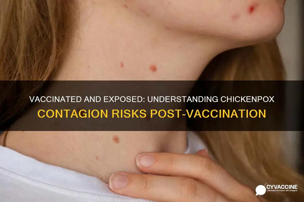 how contagious is chickenpox if vaccinated