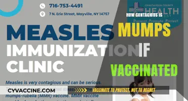 Mumps Contagiousness Post-Vaccination: Understanding Risks and Protection Levels