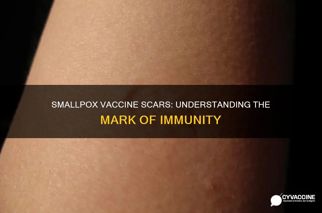 how did smallpox vaccine leave scar