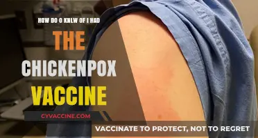 Did I Get the Chickenpox Vaccine? How to Find Out