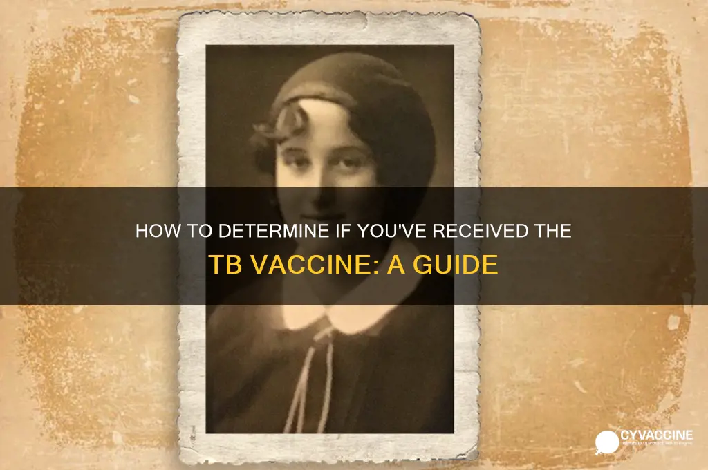 how do you if you got tb vaccine