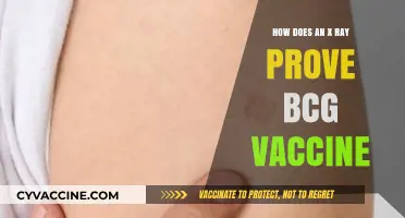 BCG Vaccine Verification: The Role of X-Rays in Proving Immunization