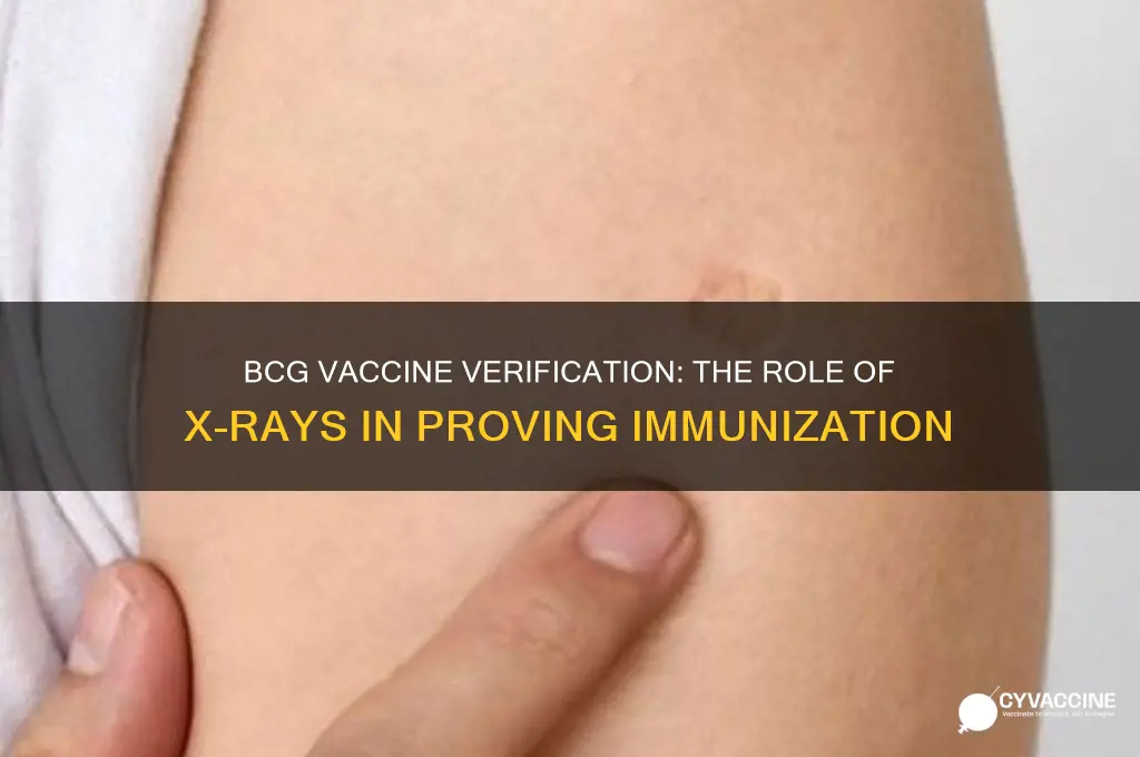 how does an x ray prove bcg vaccine