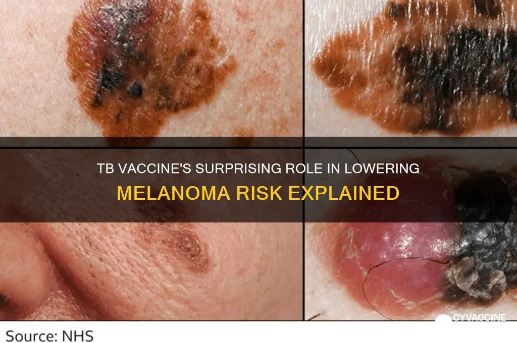 how does tb vaccine reduce risk of melanoma