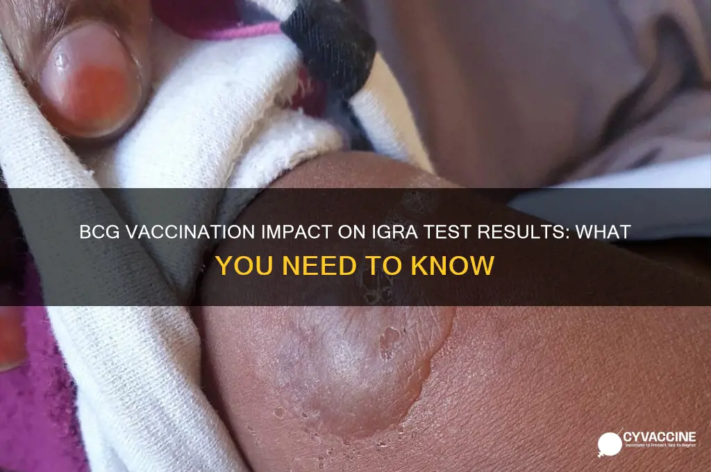 how does vaccination with bcg affect igra test