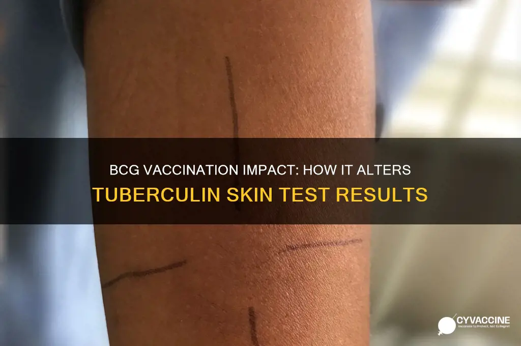 how does vaccination with bcg affect tuberculin skin test