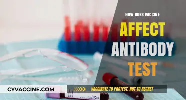 Vaccines and Antibody Tests: Understanding Their Interaction and Impact