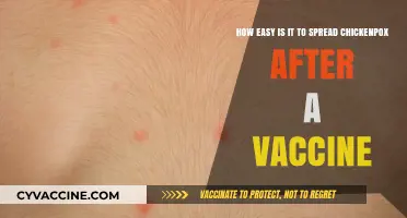 Can You Still Spread Chickenpox After Getting Vaccinated?