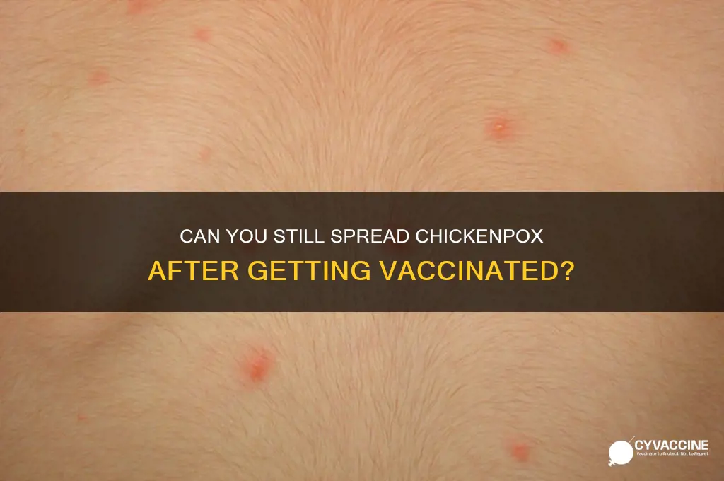 how easy is it to spread chickenpox after a vaccine