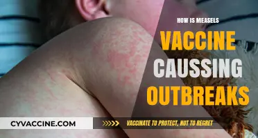 Measles Vaccine Myths Debunked: Unraveling the Outbreak Misconceptions