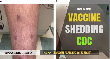 MMR Vaccine Shedding: CDC Insights and Public Health Facts