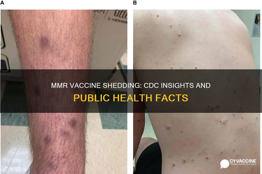how is mmr vaccine shedding cdc