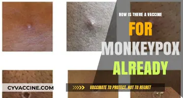 Monkeypox Vaccine: How Did It Arrive So Quickly?
