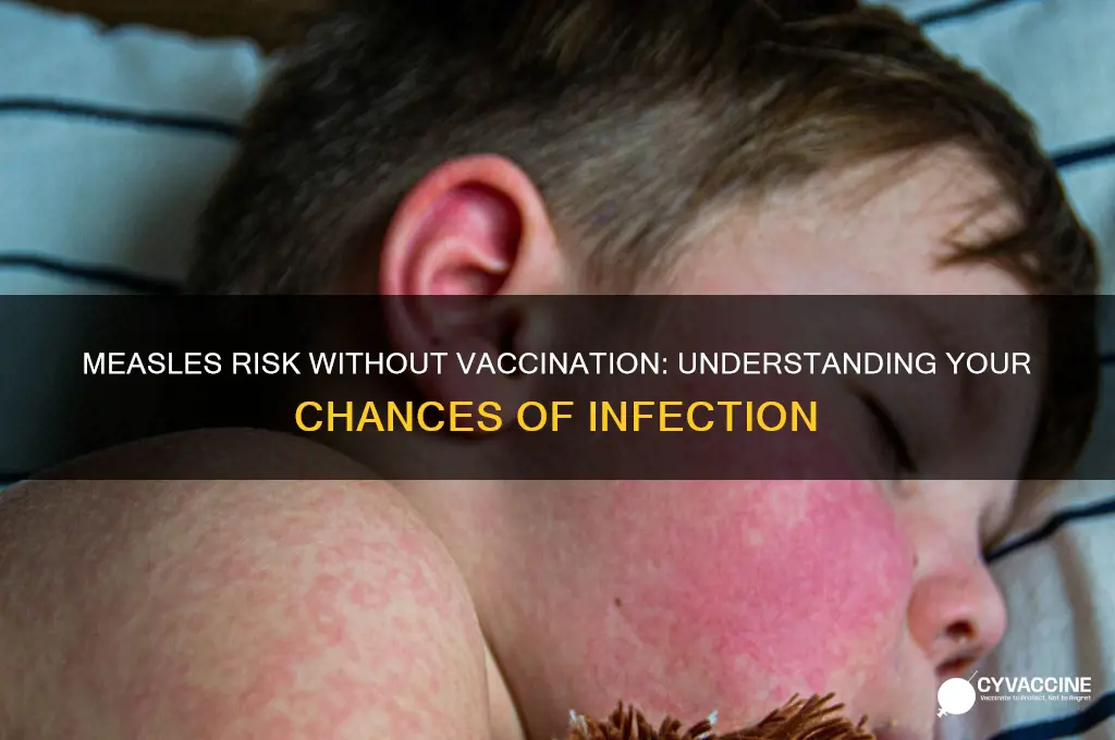 how likely are you to catch meslas if not vaccinated