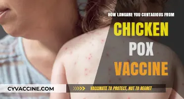 Chickenpox Vaccine Contagious Period: What You Need to Know