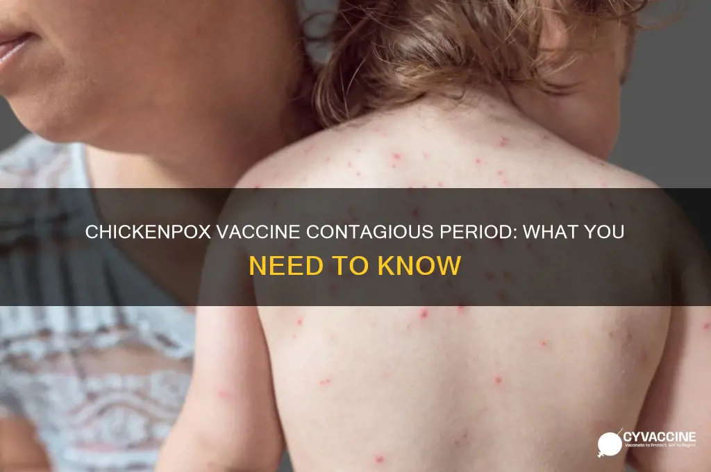 how longare you contagious from chicken pox vaccine