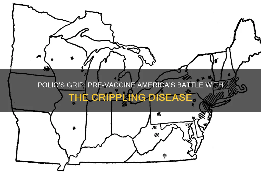 how many americans got polio before the vaccine