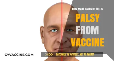 Bell's Palsy and Vaccines: Unraveling the Reported Cases