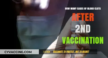 Blood Clots Post-Vaccination: Analyzing Cases After Second Dose