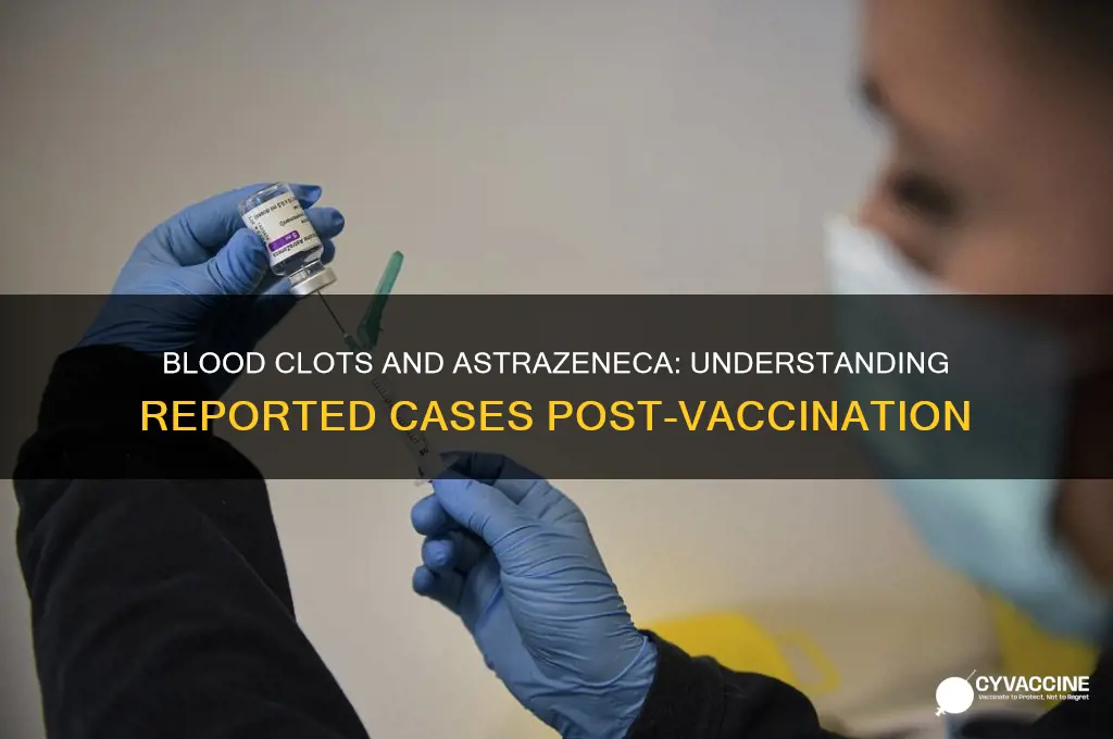 how many cases of blood clots after astrazeneca vaccine